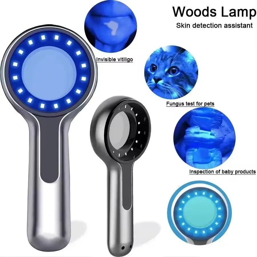 UV Magnifying Skin Analyzer – Portable Wood's Lamp